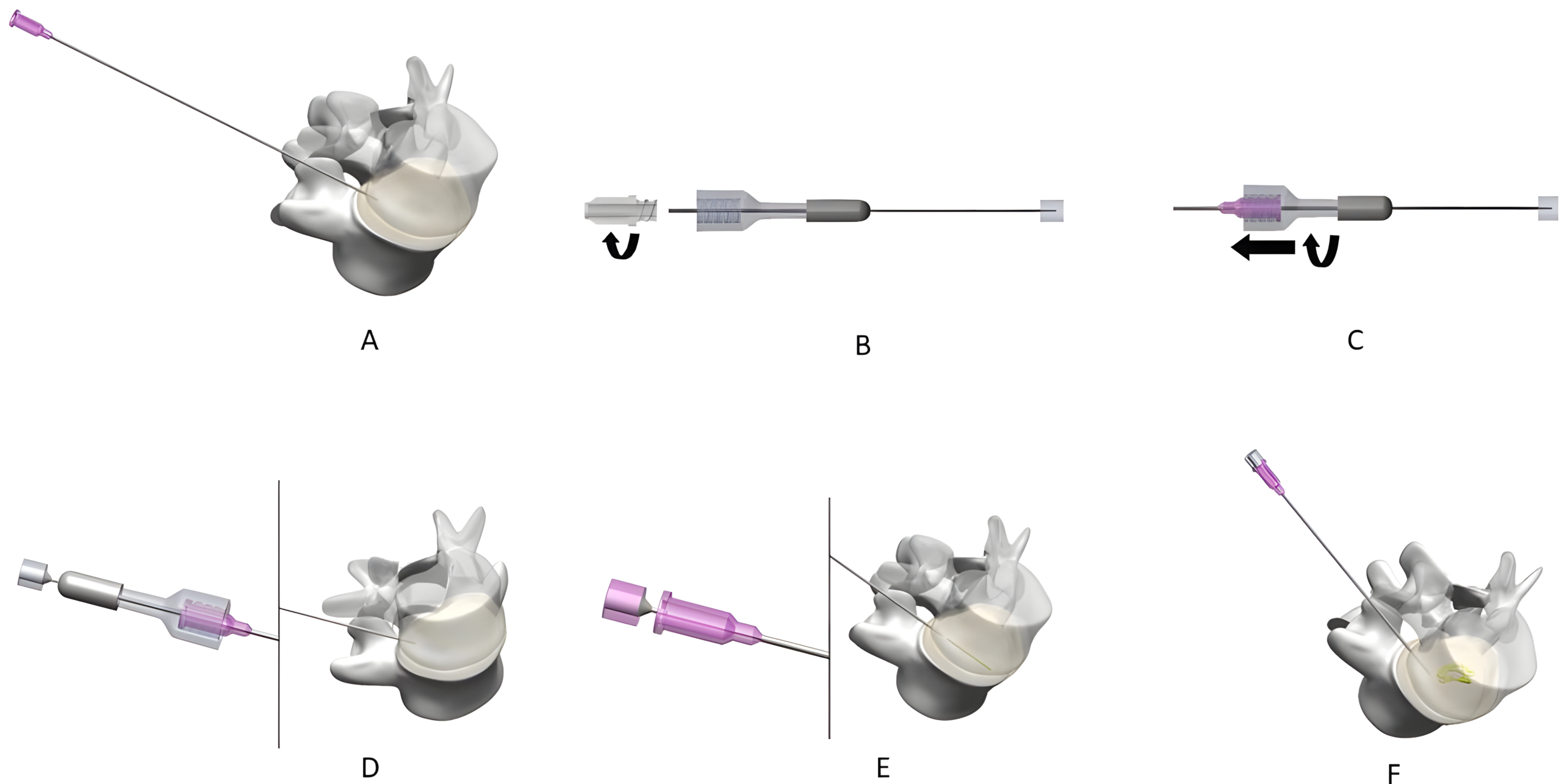 Schemat metody GELSTIX